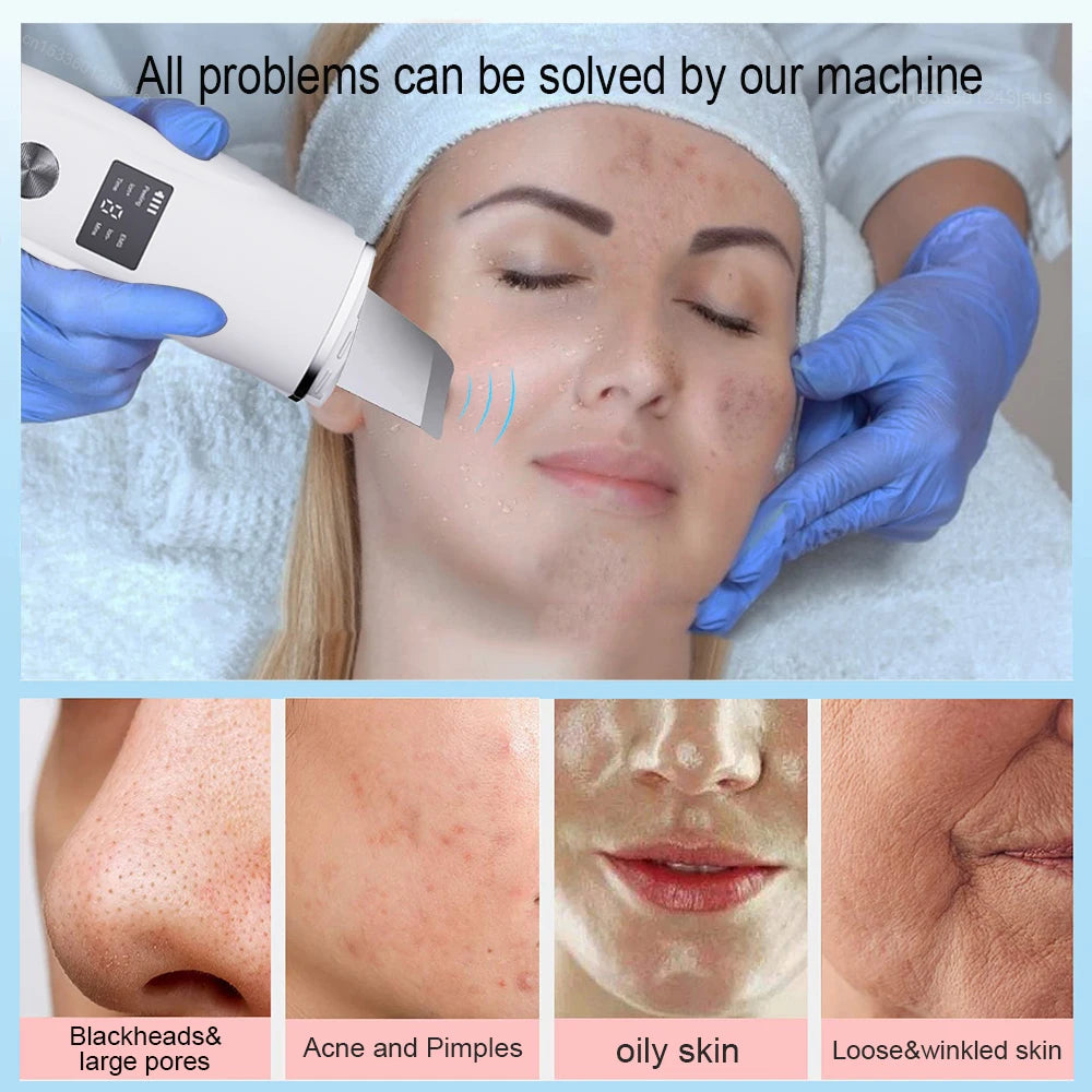 Face Scrubber Facial Peeling